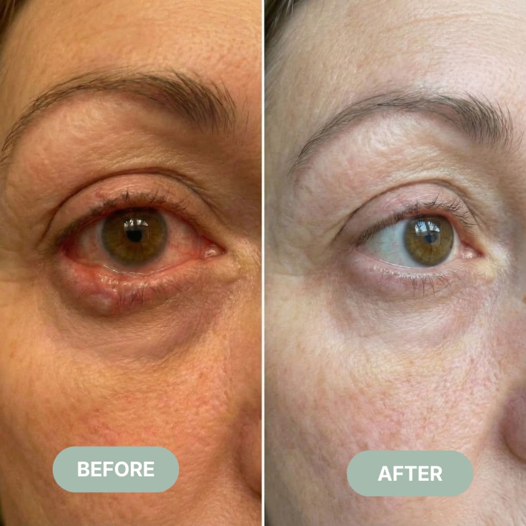 Eyvera Eye Comfort 2.0